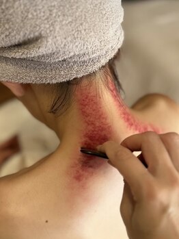 リュクス(Luxe)の写真/今までどこへ行っても改善しなかったあなたへ。マッサージ迷子はもうおわり！ぜひ一度Luxeへ☆