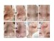 キレイラボ(Ki-Re-i LABO)の写真/【韓国式肌管理】注目サロン人気No.1★★パワーアップし進化した最新ハイドラ水素で毛穴レス肌に！【松戸】