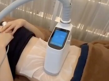 ビュヴォン(Buvons)の写真/綺麗な二の腕を目指したいなら脂肪冷却+痩身複合機◎運動、食事制限が苦手な方におススメです!