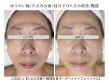 グロウ バイ フェイシャルデザイン アンド アイ(GROW)
