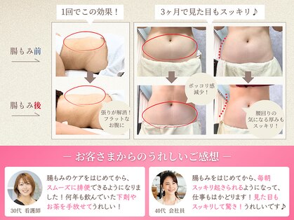 アノン 宮崎(anon)の写真