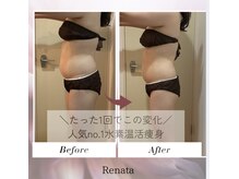 ヨサパーク レナータ(YOSA PARK Renata)