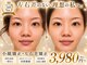 モアフェイス 池袋店(More Face)の写真