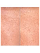 マハロ ザ ビューティー(mahalo the beauty)/フェイシャル