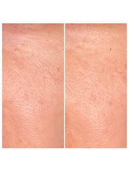 マハロ ザ ビューティー(mahalo the beauty)/フェイシャル