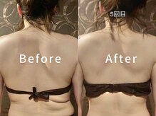 フローラ(FLORA)/天使の羽美ボディリンパ