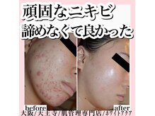 ホワイトカルム(White Calm)の雰囲気（様々なお肌悩みに合わせた豊富なメニューを取り揃えております☆）