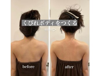 マルコ(marco)/背中ケア　症例