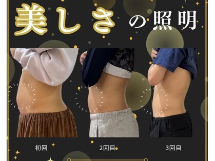 ラフィールの写真