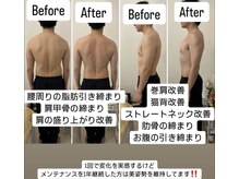 メディボーテサロン(MEDI BEAUTE SALON)/施術結果