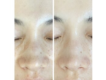 スティーン(Styin)/くすみから解放し明るい印象へ