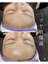 ワンダーウォール 福岡城南店(WONDER WALL)/フェイシャルワックス