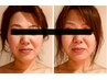 [再来]１ヶ月以内　メリディアンヘッドスパ＋脳幹デトックスフルコース