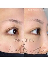 ネイルアンドアイラッシュ アリア(Alia)/ビフォーアフター