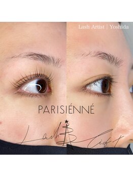 ネイルアンドアイラッシュ アリア(Alia)/ビフォーアフター