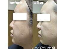 サロン リノ(SALON Lino)/ビフォーアフター