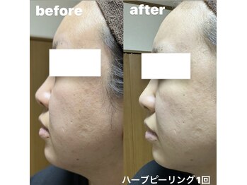 サロン リノ(SALON Lino)/ビフォーアフター