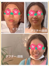 ルクシア(Luxia)/整ったお顔