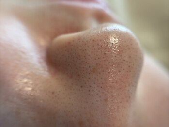 リセットプラス(Reset+)/