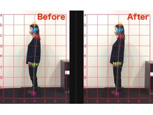 Before After☆効果実感！実力派スタッフが悩みを解決!!