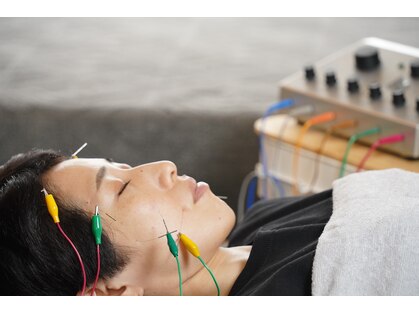 あかり鍼灸接骨院の写真