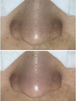 フラリス(fraris)/