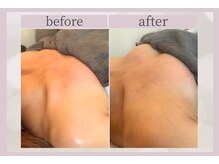 ミロワール(Miroire)/美姿勢×美バスト