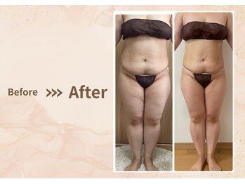 プラム(plum)/セルゼロ２