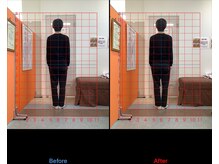 ゼロヒャク整骨院(ZERO100整骨院)/猫背矯正×骨盤矯正