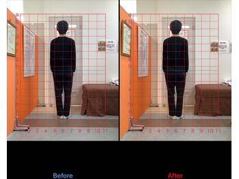 ゼロヒャク整骨院(ZERO100整骨院)/猫背矯正×骨盤矯正