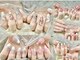 ミラクルネイル(Miracle Nail)の写真