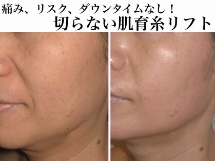 Nビューティーの写真