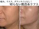 Nビューティーの写真