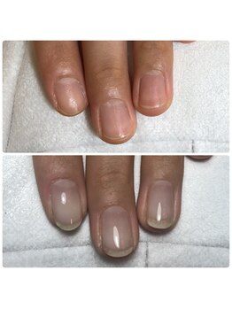 【美爪式】自爪育成