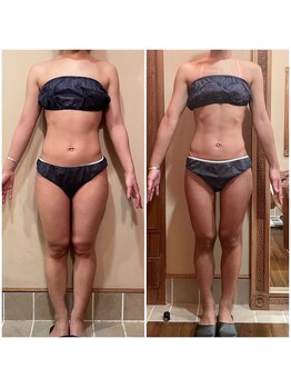 ビューティースタイリング 自由が丘店(beauty styling)/《5回コース》