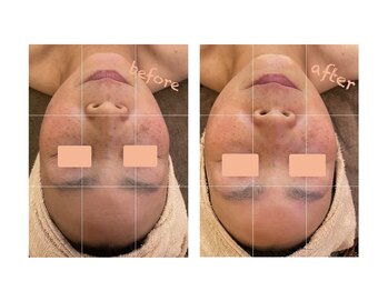 モーンガータ(mangata)/《BeforeAfter》