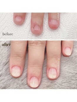 ルナルーチェ(Luna luce)/深爪メニュー