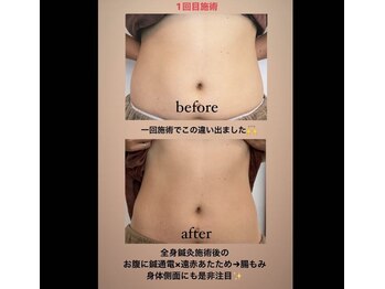 トナリ鍼灸院/スリミング