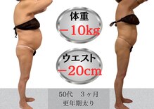 ルポーゼ(Repose)