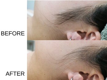 アニュ(a nu)/プロにお任せ、お顔シェービング