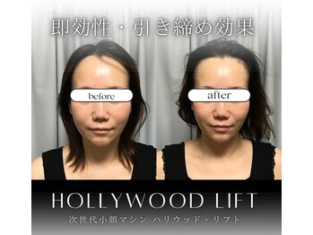 ブリリオプラス 四条烏丸店(Brillio plus)/