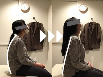 ミライズ整体院 三宮本院/事例【20代女性・首こり】