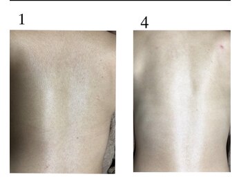 クサカンムリ(KUSAKANMURI)/背中