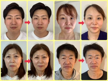 サプル(supple)の写真