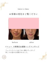 ルブラン(Le Blanc)/before after のお写真