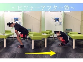 ケアるら整骨院 富里院/ビフォーアフター