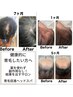 【月曜限定 祝日〇】違いを実感/結果が分かる育毛促進ヘッドスパ60分