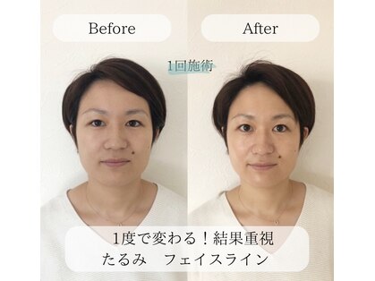 オンリ(ONRI)の写真