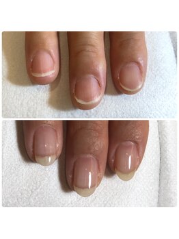 【美爪式】自爪育成