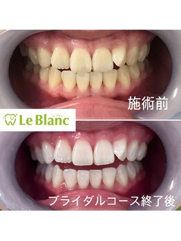ルブラン 奈良店(Le Blanc)/まだ間に合います！